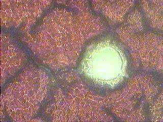 Foto einer Mikroskopaufnahme von Blutzellen