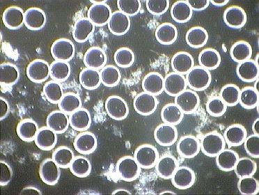Foto einer Dunkelfeld-Mikroskopaufnahme des Blutes