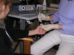 Foto einer Elektroakupunkturbehandlung durch Heilpraktikerin mit einem Stift am Daumen